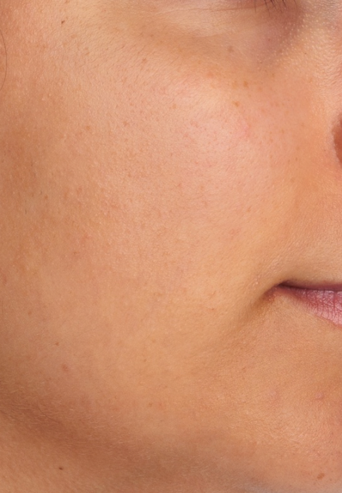 L’Or Céleste Ritual before and after — Right cheek comparison, participant 2 — after