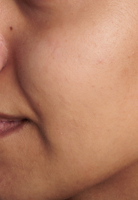 L’Or Céleste Ritual before and after — Cheek comparison, participant 5 — after
