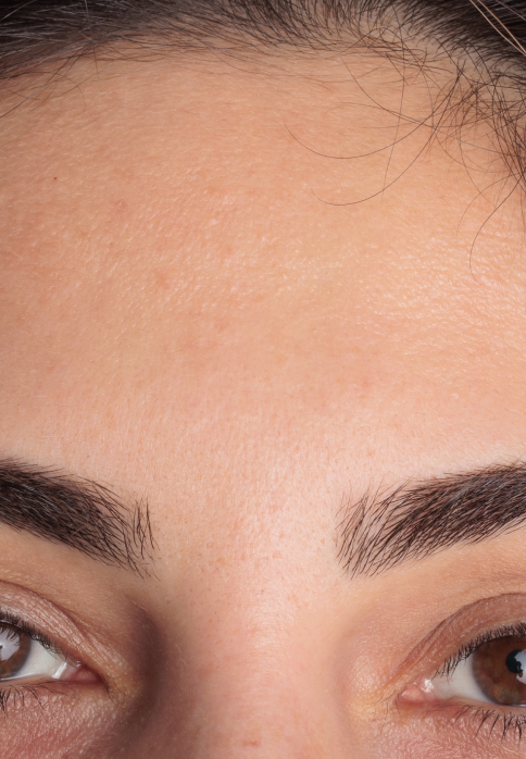 L’Or Céleste Ritual before and after — Forehead and brow comparison, participant 8 — after
